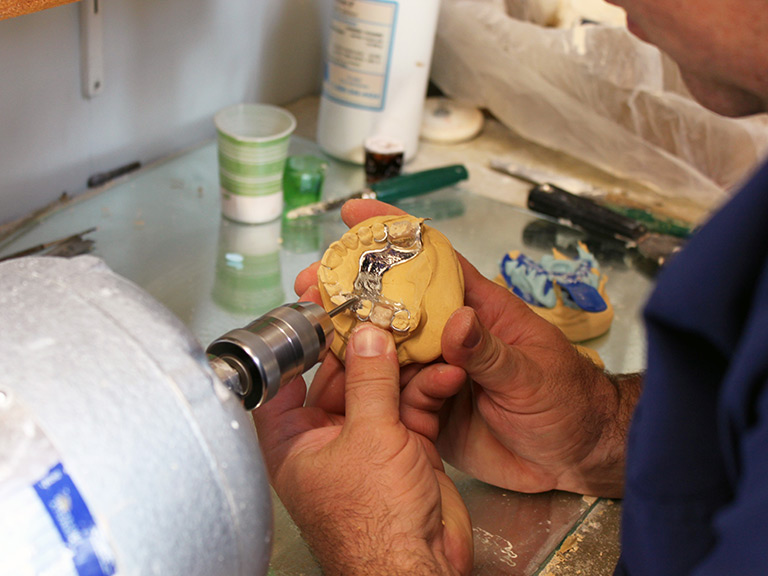 Denture Making